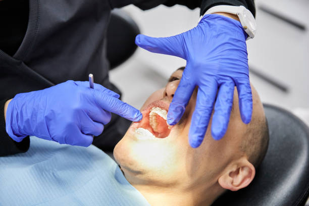 Best Emergency Root Canal Treatment in Sylva, NC